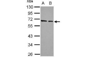WB Image Sample (30 ug of whole cell lysate) A: A549 B: HeLa 10% SDS PAGE antibody diluted at 1:5000 (KLF4 anticorps  (C-Term))
