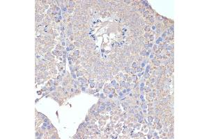 Immunohistochemistry of paraffin-embedded mouse testis using COX5A antibody (ABIN6130953, ABIN6138912, ABIN6138913 and ABIN6222082) at dilution of 1:100 (40x lens).