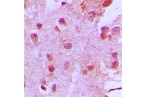 Immunohistochemical analysis of Menin staining in human brain formalin fixed paraffin embedded tissue section.