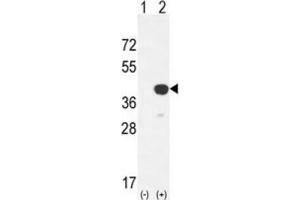 Western Blotting (WB) image for anti-Cathepsin K (CTSK) antibody (ABIN3003176)