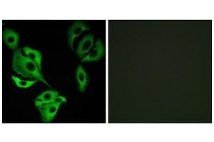 Immunofluorescence (IF) image for anti-AarF Domain Containing Kinase 4 (ADCK4) (N-Term) antibody (ABIN1849898) (ADCK4 anticorps  (N-Term))