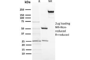 SDS-PAGE Analysis Purified ACTH Mouse Monoclonal Antibody (57). (POMC anticorps  (N-Term))