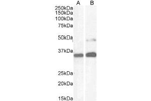 ABIN184783 (1µg/ml) staining of Human Kidney (A) and HeLa cell (B) lysate (35µg protein in RIPA buffer). (PAX8 anticorps  (N-Term))