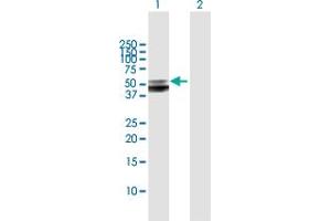 Western Blot analysis of SERPINA12 expression in transfected 293T cell line by SERPINA12 MaxPab polyclonal antibody. (SERPINA12 anticorps  (AA 1-414))