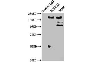 Immunoprecipitating IKBKAP in Hela whole cell lysate Lane 1: Rabbit control IgG instead of ABIN7151572 in Hela whole cell lysate.