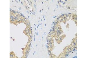 Immunohistochemistry of paraffin-embedded Human prostate using ENPEP Polyclonal Antibody at dilution of 1:200 (40x lens). (ENPEP anticorps)