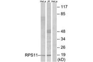 Western Blotting (WB) image for anti-Ribosomal Protein S11 (RPS11) (AA 71-120) antibody (ABIN2890060) (RPS11 anticorps  (AA 71-120))