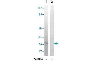 Western blot analysis of extracts from 293 cells, using MRPL16 polyclonal antibody . (MRPL16 anticorps)