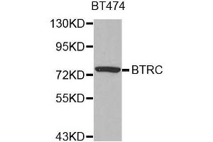 Western blot analysis of extracts of BT474 cell line, using BTRC antibody. (BTRC anticorps  (AA 50-340))