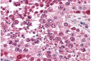 Human Testis (formalin-fixed, paraffin-embedded) stained with TRIM17 antibody ABIN213719 at 2.