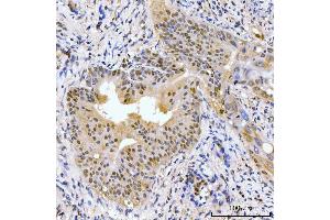 IHC analysis of AKAP 95/AKAP8 using anti-AKAP 95/AKAP8 antibody (ABIN7601553). (AKAP8 anticorps  (AA 380-546))