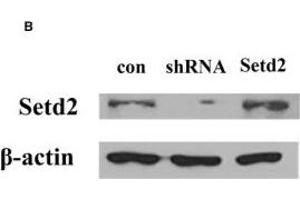 Setd2 promotes PDLCs osteogenic differentiation stimulated by Sr.