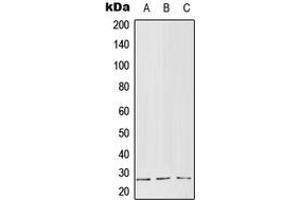 Western blot analysis of RGS5 expression in MCF7 (A), Raw264. (RGS5 anticorps  (Center))