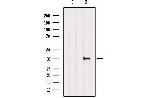Western blot analysis of extracts from Mouse lung, using IkappaB-alpha Antibody.