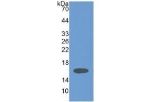 WB of Protein Standard: different control antibodies  against Highly purified E. (HPSE Kit ELISA)