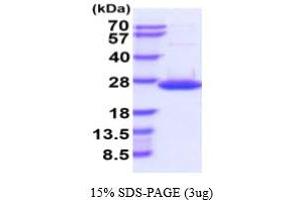 SDS-PAGE (SDS) image for Dual Specificity Phosphatase 18 (DUSP18) (AA 1-188) (Active) protein (His tag) (ABIN6388006)