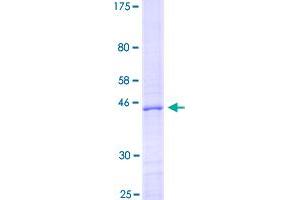 Image no. 1 for Myelin Basic Protein (MBP) (AA 1-160) protein (GST tag) (ABIN2565162)