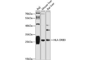 Western blot analysis of extracts of various cell lines, using HLA-DRB3 antibody (ABIN6131761, ABIN6141833, ABIN6141834 and ABIN6216072) at 1:1000 dilution. (HLA-DRB3 anticorps  (AA 30-227))