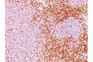 Image no. 1 for anti-CD6 (CD6) antibody (ABIN6160102) (CD6 anticorps)