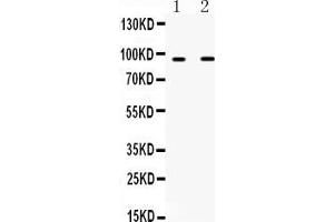 Western blot analysis of IFNGR1 using anti-IFNGR1 antibody . (IFNGR1 anticorps  (C-Term))