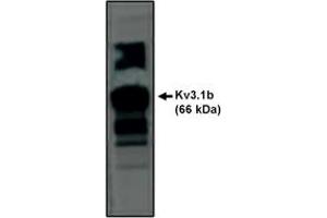Image no. 1 for anti-Potassium Voltage-Gated Channel, Shaw-Related Subfamily, Member 1 (KCNC1) antibody (ABIN201687) (KCNC1 anticorps)