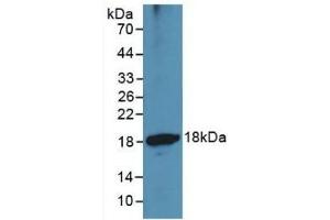 Detection of Recombinant ADAMTS1, Human using Monoclonal Antibody to A Disintegrin And Metalloproteinase With Thrombospondin 1 (ADAMTS1)