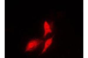 Immunofluorescent analysis of S6K1 staining in HeLa cells. (RPS6KB1 anticorps  (C-Term))