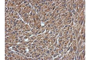 IHC-P Image Immunohistochemical analysis of paraffin-embedded U87 xenograft, using VAMP1, antibody at 1:500 dilution.