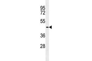 TMPRSS11E2 antibody western blot analysis in NCI-H292 lysate.