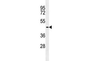 TMPRSS11E2 antibody western blot analysis in NCI-H292 lysate. (TMPRSS11E anticorps  (AA 249-277))