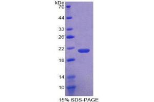 SDS-PAGE (SDS) image for Coagulation Factor II (thrombin) (F2) (AA 44-198) protein (His tag) (ABIN1877316)