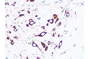 Immunohistochemistry of paraffin-embedded mouse spinal cord using FMRP Rabbit mAb (ABIN1679778, ABIN3019025, ABIN3019026 and ABIN7101703) at dilution of 1:100 (40x lens). (FMR1 anticorps)