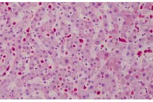 Human Liver: Formalin-Fixed, Paraffin-Embedded (FFPE) (CARD11 anticorps  (AA 18-238))