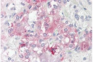 Image no. 2 for anti-RalA Binding Protein 1 (RALBP1) (N-Term) antibody (ABIN6749754)