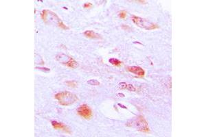 Immunohistochemical analysis of AKT2 staining in human brain formalin fixed paraffin embedded tissue section.