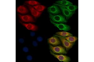 ABIN7093376 and ABIN7097396 staining Hela cells by IF/ICC. (MAP3K3 anticorps)