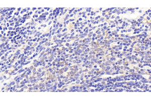 Detection of COX2 in Rat Spleen Tissue using Polyclonal Antibody to Cytochrome C Oxidase Subunit II (COX2)