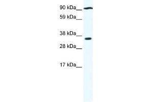 PARP16 antibody used at 0. (PARP16 anticorps)