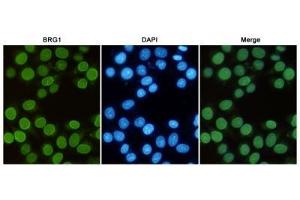 Immunofluorescent analysis of Hela cells fixed with 4 % Paraformaldehyde and using anti-BRG1 mouse mAb (dilution 1:50).