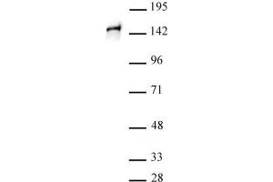 STAG1 antibody (pAb) tested by Western blot. (Stromal Antigen 1 anticorps  (C-Term))