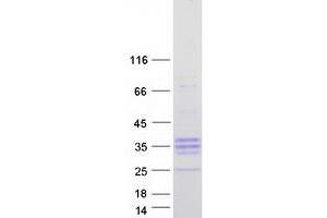 Validation with Western Blot
