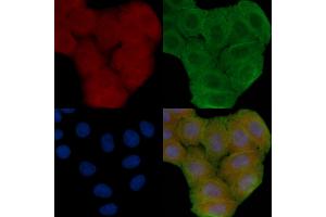 ABIN6258807 and ABIN6273863 staining Hela cells(30 min of UV treatment) by IF/ICC. (GPR25 anticorps  (Internal Region))