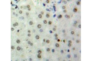 Used in DAB staining on fromalin fixed paraffin-embedded Liver tissue (HIST2H2BE anticorps  (AA 2-126))