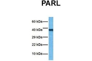 Host:  Rabbit  Target Name:  PARL  Sample Tissue:  Human Jurkat  Antibody Dilution:  1.