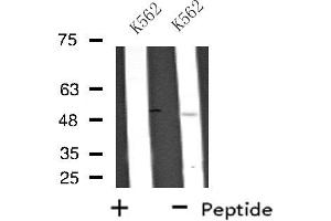 Western blot analysis of extracts from K562 cells, using UBFD1 antibody. (UBFD1 anticorps  (Internal Region))