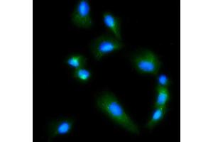IF analysis of Glutaminase/GLS using anti-Glutaminase/GLS antibody (ABIN7601603). (Glutaminase anticorps  (AA 396-654))