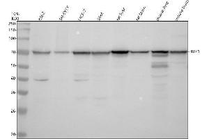 Western blot analysis of HBP1 using anti-HBP1 antibody (ABIN7825459).