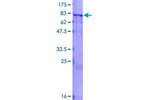 Image no. 1 for Zinc Finger Protein 155 (ZNF155) (AA 1-538) protein (GST tag) (ABIN1325898)