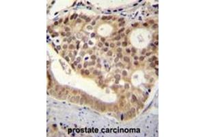 C11orf53 antibody (C-term) immunohistochemistry analysis in formalin fixed and paraffin embedded human pancreas tissue followed by peroxidase conjugation of the secondary antibody and DAB staining. (C11orf53 anticorps  (C-Term))