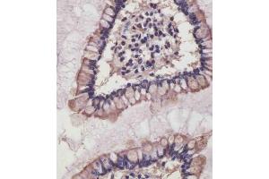 (ABIN6242485 and ABIN6578840) staining NRAS in human small intestine tissue sections by Immunohistochemistry (IHC-P - paraformaldehyde-fixed, paraffin-embedded sections). (GTPase NRas anticorps)
